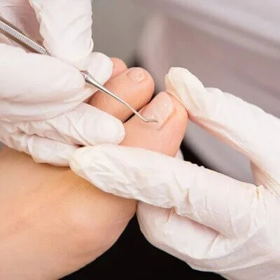 nail surgery